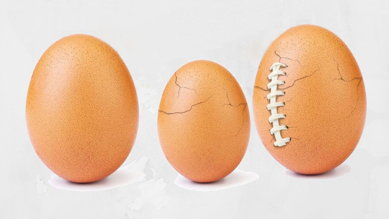 Ананың юбкасының астындағы ресейлік фотосуреттер Брянскіде жыныстық қатынас